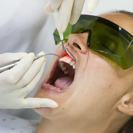A dentist using laser dentistry on a patient's gums