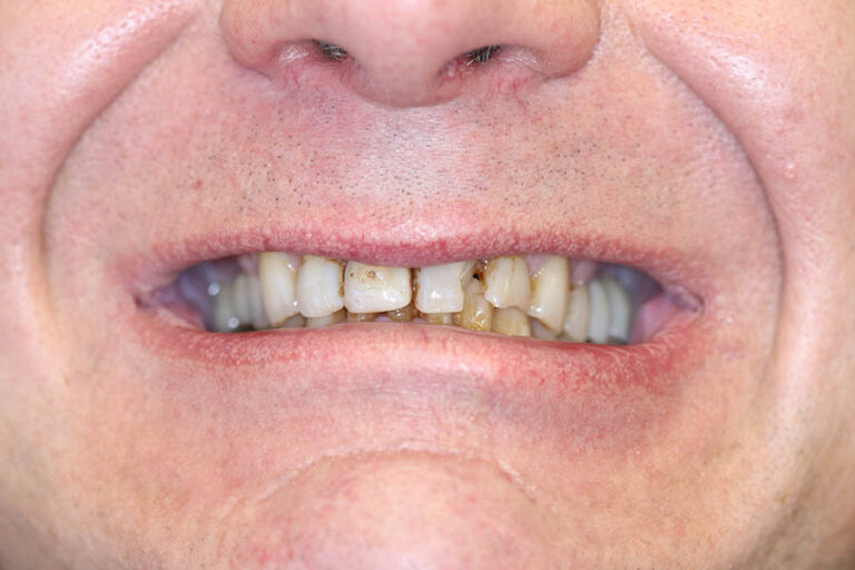 Dentist in Encino, CA Smile Gallery Encino Cosmetic & Dental Implants