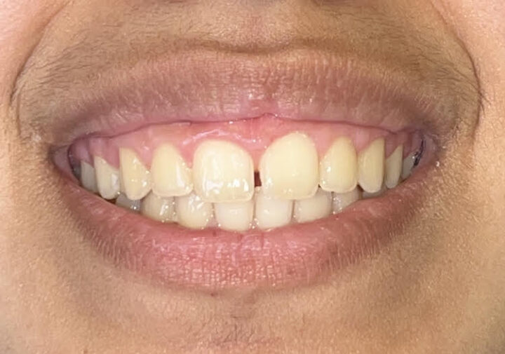 Dentist in Encino, CA Smile Gallery Encino Cosmetic & Dental Implants