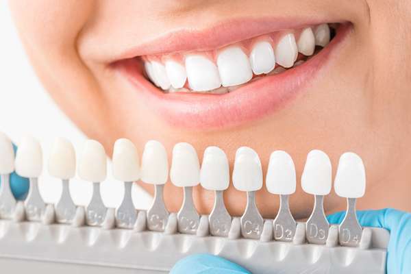 Ask a Cosmetic Dentist: What Are Veneers from Encino Cosmetic & Dental Implants in Encino, CA