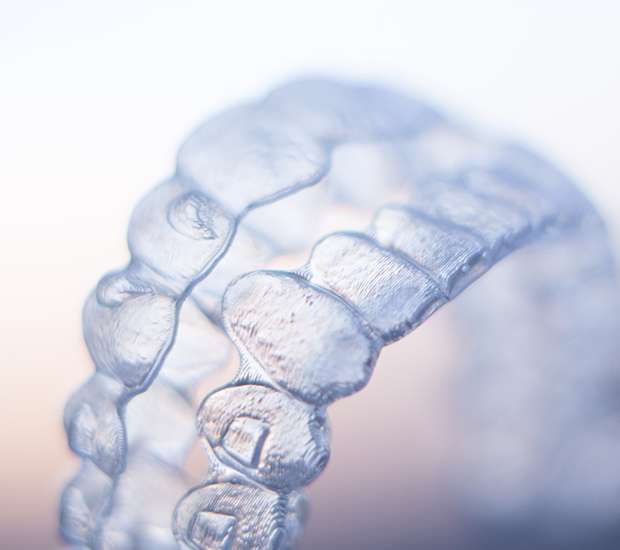 Encino ClearCorrect Braces