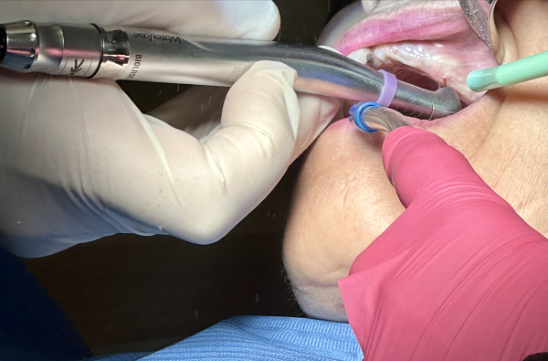 Photo of Dr. Bina Waterlase Dental Laser