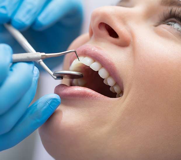 Encino Dental Bonding