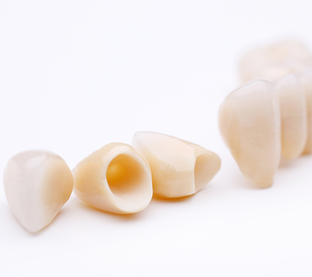 Encino Dental Crowns and Dental Bridges
