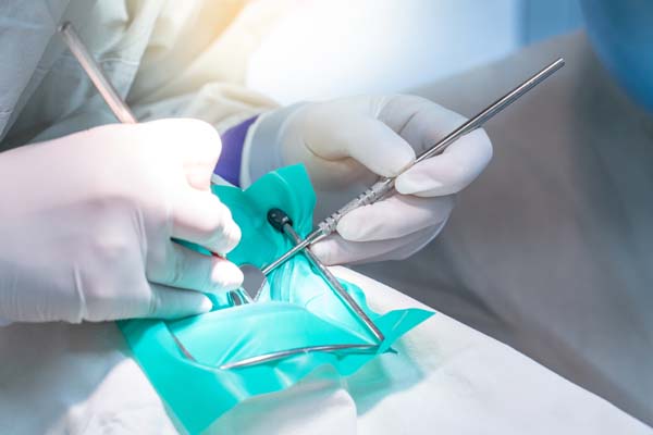 Dental Emergencies: What To Do For Broken Teeth