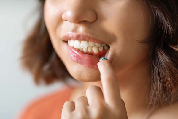 Tips For Preventing Gum Disease