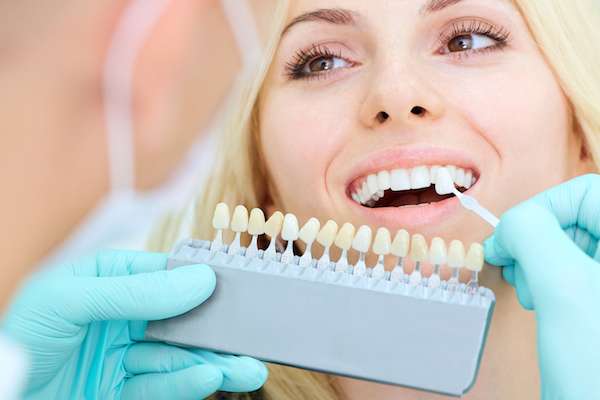How a Cosmetic Dentist Places Dental Veneers from Encino Cosmetic & Dental Implants in Encino, CA