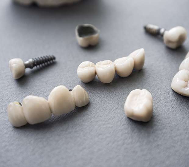 Encino The Difference Between Dental Implants and Mini Dental Implants