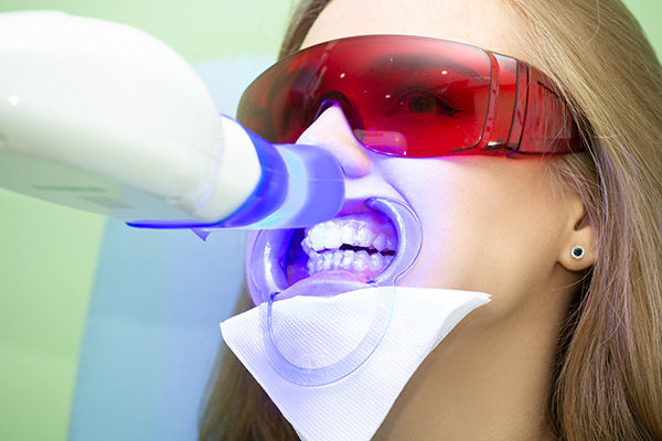 Laser Teeth Whitening And Possible Effects On Gums
