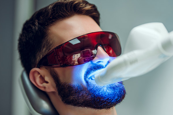 Laser Teeth Whitening And Teeth Sensitivity To Staining