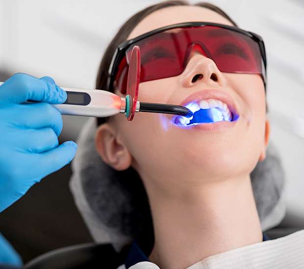 Encino Professional Teeth Whitening
