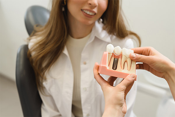 Options for Replacing Missing Teeth: Do I Have to Get Dental Implants? from Encino Cosmetic & Dental Implants in Encino, CA