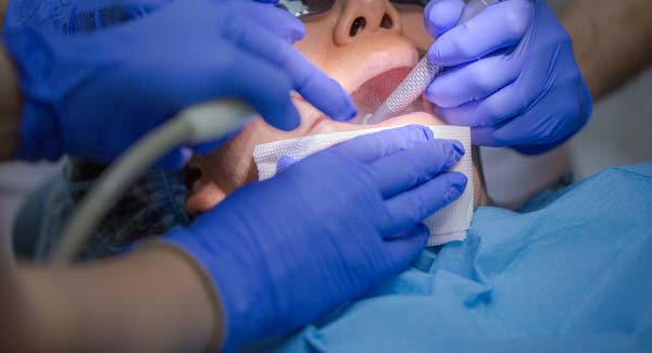 Relieving Pain With Root Canal Therapy